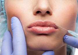 Hyaluronic Acid Fillers